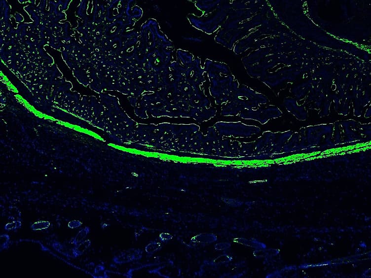 Creation of Abdominal Adhesions in Mice