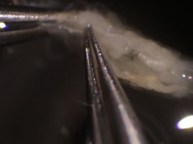 Methods to Examine the Lymph Gland and Hemocytes in <em>Drosophila</em> Larvae