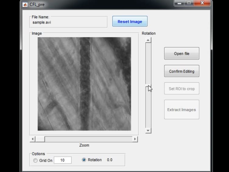 Visualization and Quantification of the Cell-free Layer in Arterioles of the Rat Cremaster Muscle
