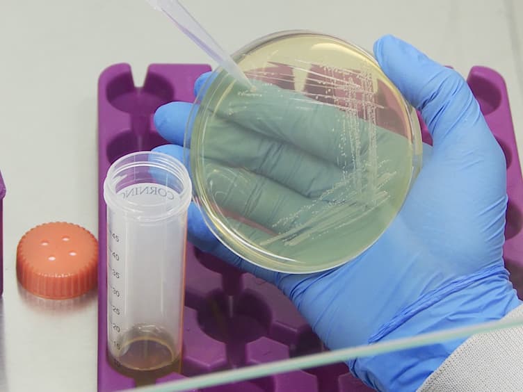 Experimental Infection with <em>Listeria monocytogenes</em> as a Model for Studying Host Interferon-γ Responses