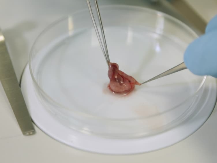 The Production of Pluripotent Stem Cells from Mouse Amniotic Fluid Cells Using a Transposon System