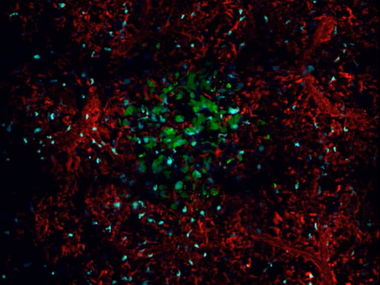 Long-term High-Resolution Intravital Microscopy in the Lung with a Vacuum Stabilized Imaging Window