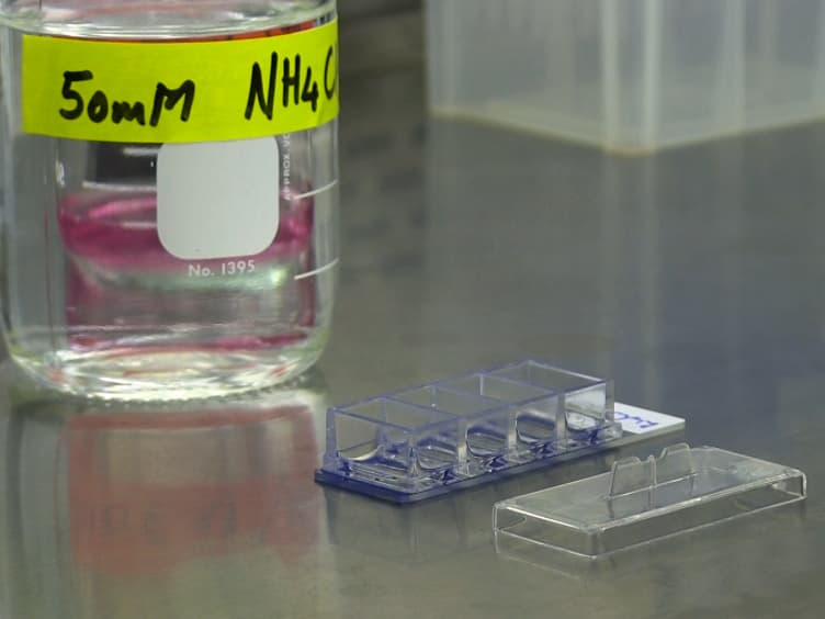 Visualizing the Early Stages of Phagocytosis