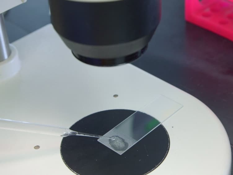 Techniques for Imaging Prometaphase and Metaphase of Meiosis I in Fixed Drosophila Oocytes