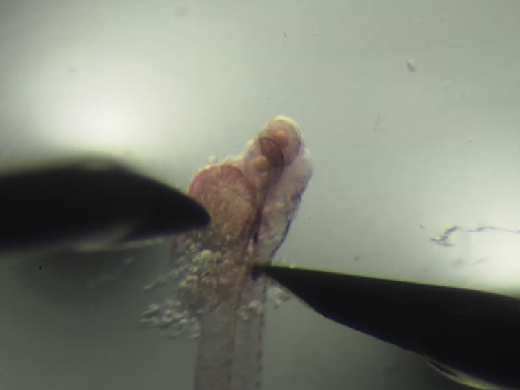 Visualizing the Interrenal Steroidogenic Tissue and Its Vascular Microenvironment in Zebrafish