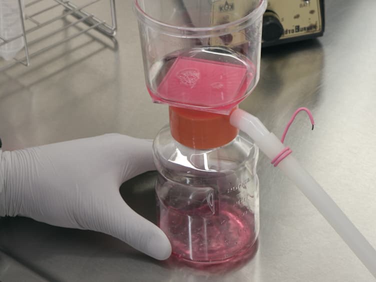 Development of a Hepatitis B Virus Reporter System to Monitor the Early Stages of the Replication Cycle