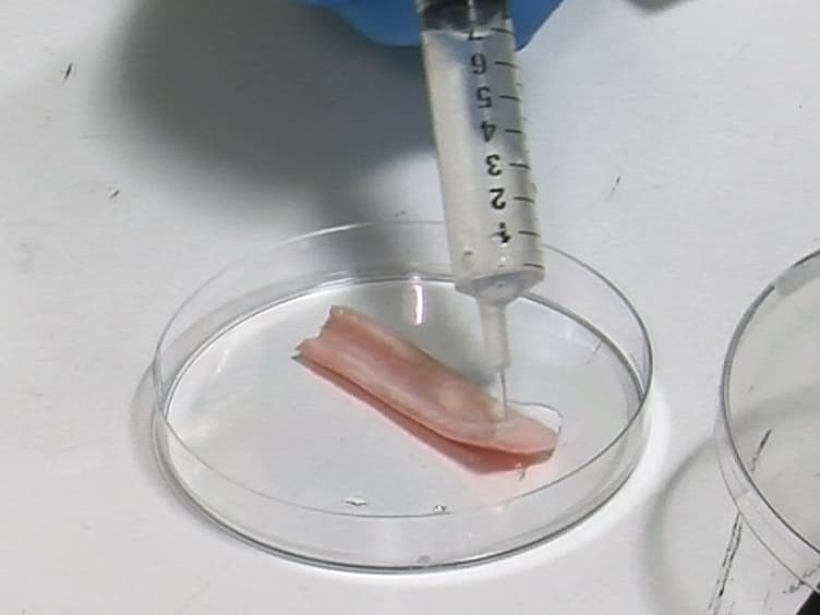 Biomechanical Characterization of Human Soft Tissues Using Indentation and Tensile Testing