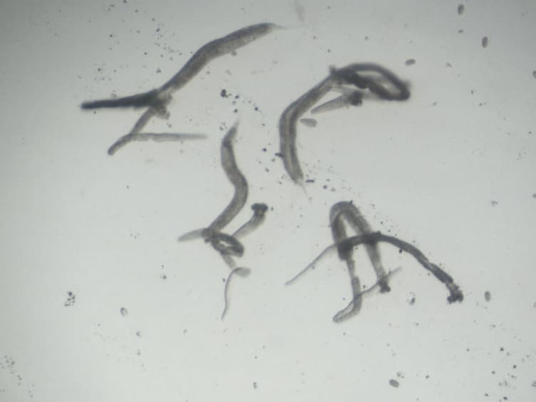 Spatial and Temporal Analysis of Active ERK in the <em>C. elegans</em> Germline