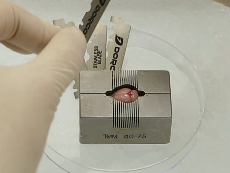 Isolation and Culture of Adult Neural Stem Cells from the Mouse Subcallosal Zone