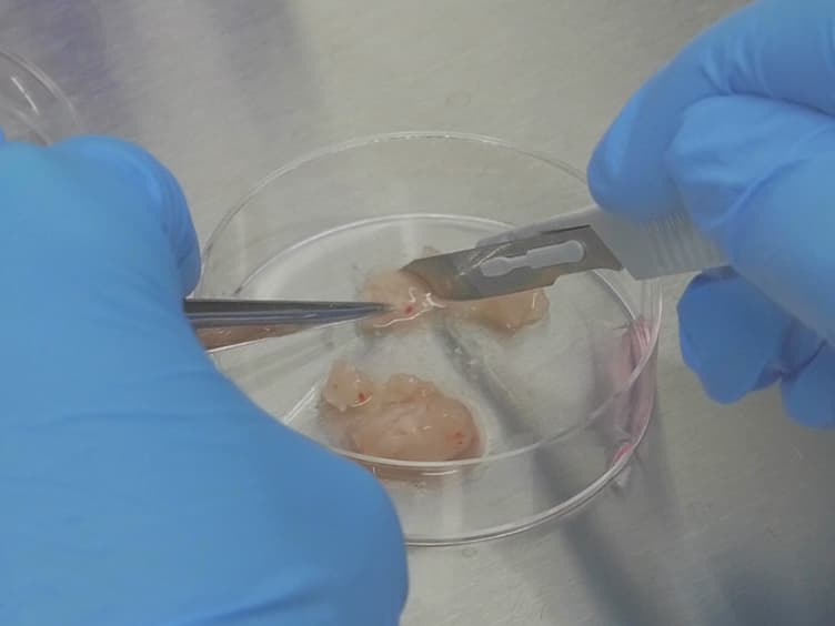 Labeling of Breast Cancer Patient-derived Xenografts with Traceable Reporters for Tumor Growth and Metastasis Studies