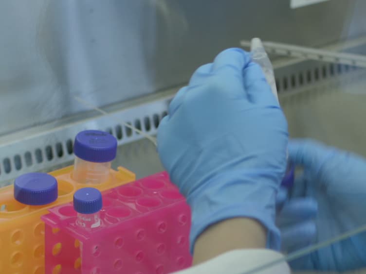 Low-Density Primary Hippocampal Neuron Culture