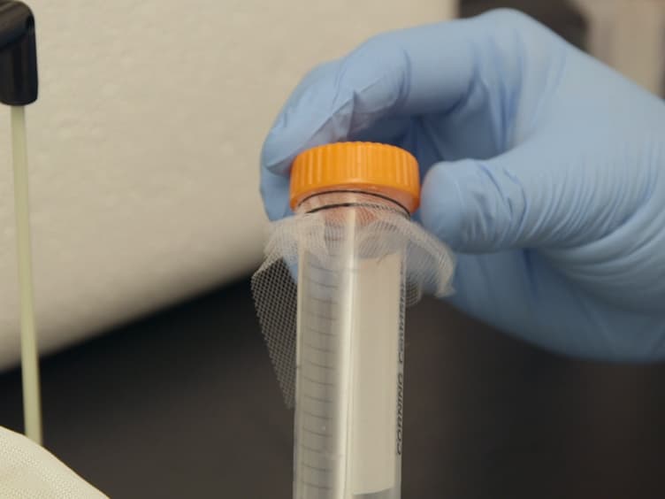 Inoculating Anopheles gambiae Mosquitoes with Beads to Induce and Measure the Melanization Immune Response