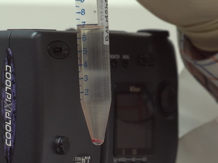 Detection of Inter-chromosomal Stable Aberrations by Multiple Fluorescence In Situ Hybridization mFISH and Spectral Karyotyping SKY in Irradiated Mice