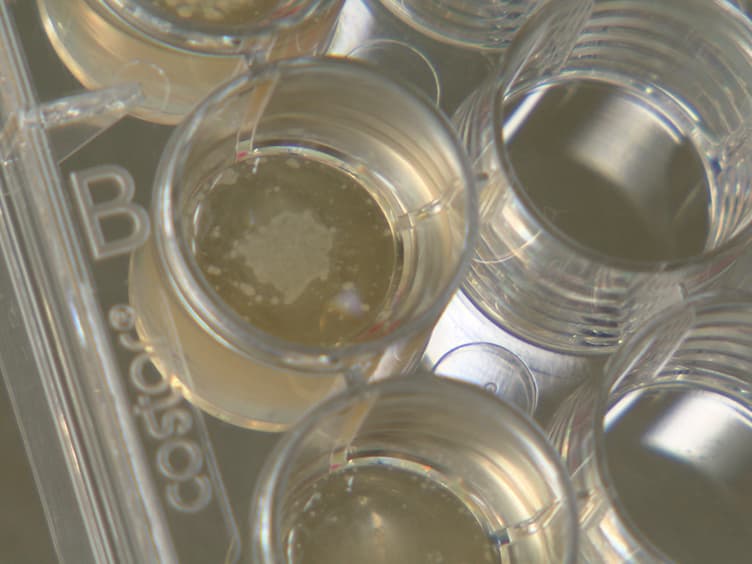 A Simple Red Blood Cell Lysis Method for the Establishment of B Lymphoblastoid Cell Lines