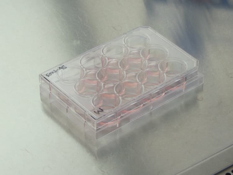 Efficient Differentiation of Pluripotent Stem Cells to NKX6-1<sup>+</sup> Pancreatic Progenitors