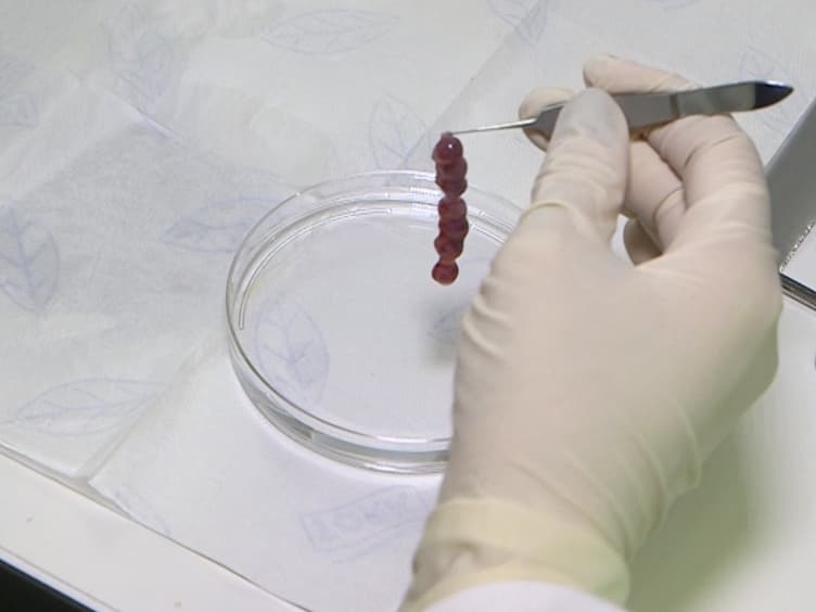 Identification Of Erythromyeloid Progenitors And Their Progeny In The Mouse Embryo By Flow Cytometry