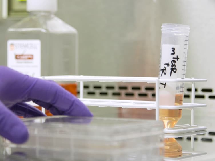 Defined and Scalable Generation of Hepatocyte-like Cells from Human Pluripotent Stem Cells
