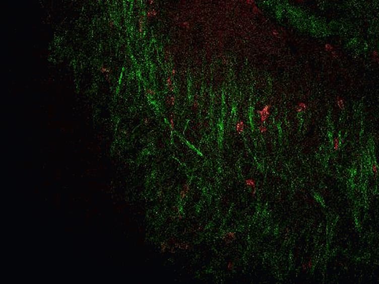 Visualizing Angiogenesis by Multiphoton Microscopy<em> In Vivo</em> in Genetically Modified 3D-PLGA/nHAp Scaffold for Calvarial Critical Bone Defect Repair