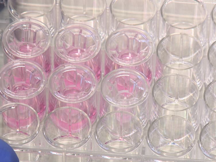 Analysis of Lymphocyte Extravasation Using an <em>In Vitro</em> Model of the Human Blood-brain Barrier