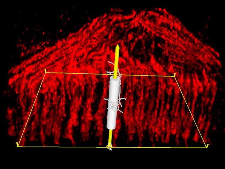 Analyzing Dendritic Morphology in Columns and Layers