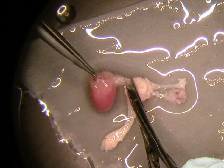 En Face Preparation of Mouse Blood Vessels