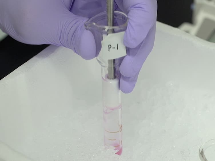Detection of microRNA Expression in Peritoneal Membrane of Rats Using Quantitative Real-time PCR