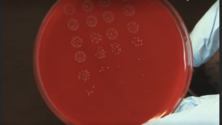 Expression, Purification, and Antimicrobial Activity of S100A12