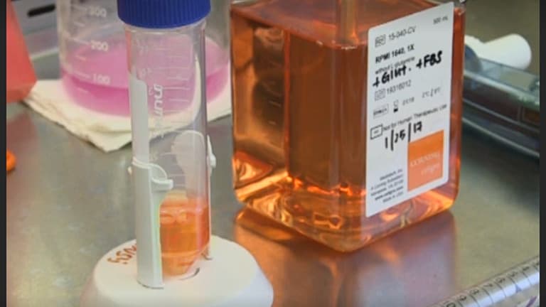 An In Vitro Caseum Binding Assay that Predicts Drug Penetration in Tuberculosis Lesions
