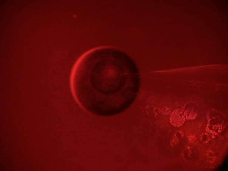 Voltage-clamp Fluorometry in <em>Xenopus</em> Oocytes Using Fluorescent Unnatural Amino Acids