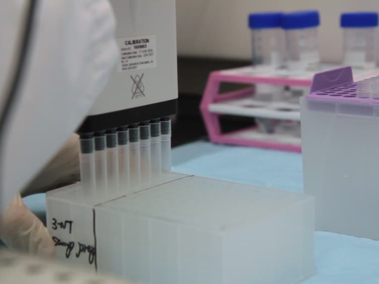 Integration of Miniaturized Solid Phase Extraction and LC-MS/MS Detection of 3-Nitrotyrosine in Human Urine for Clinical Applications