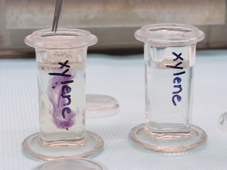 Sectioning Mammary Gland Whole Mounts for Lesion Identification