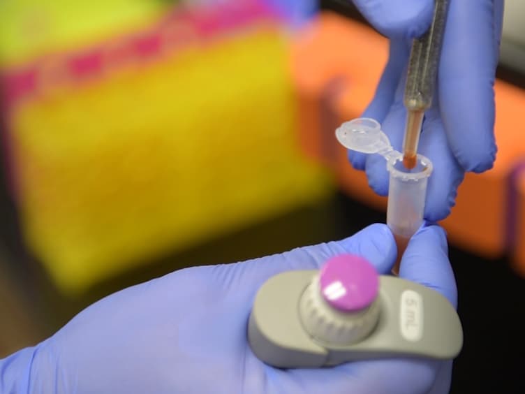 Foodborne Pathogen Screening Using Magneto-fluorescent Nanosensor: Rapid Detection of <em>E. Coli</em> O157:H7