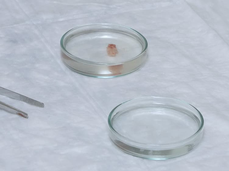Spinal Cord Neurons Isolation and Culture from Neonatal Mice