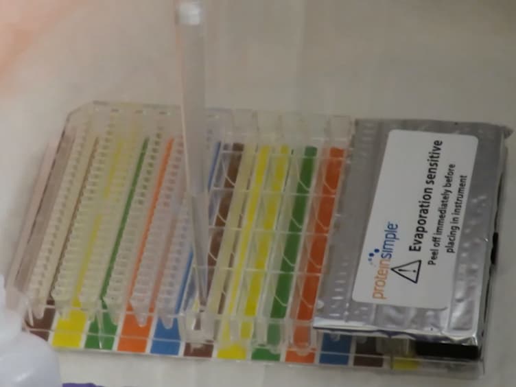 Procedure and Key Optimization Strategies for an Automated Capillary Electrophoretic-based Immunoassay Method