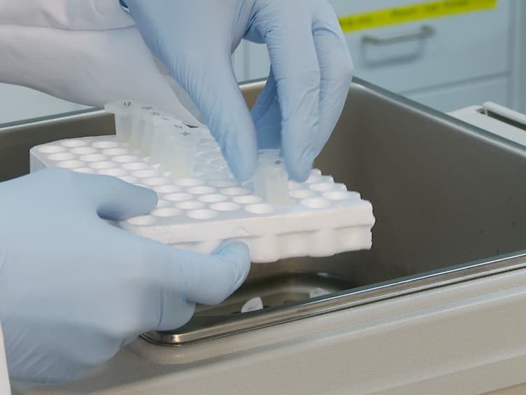 Peptide and Protein Quantification Using Automated Immuno-MALDI (iMALDI)