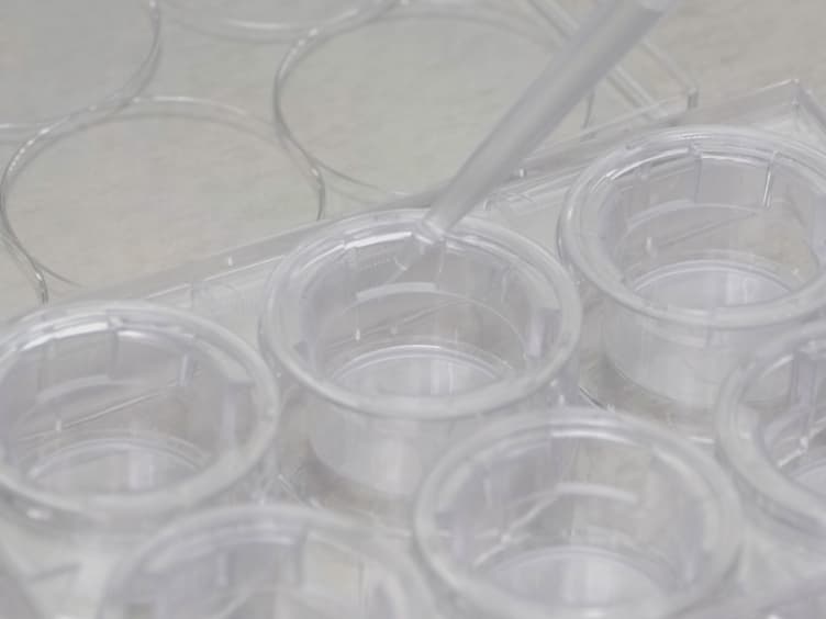 A Cell Culture Model of Resistance Arteries