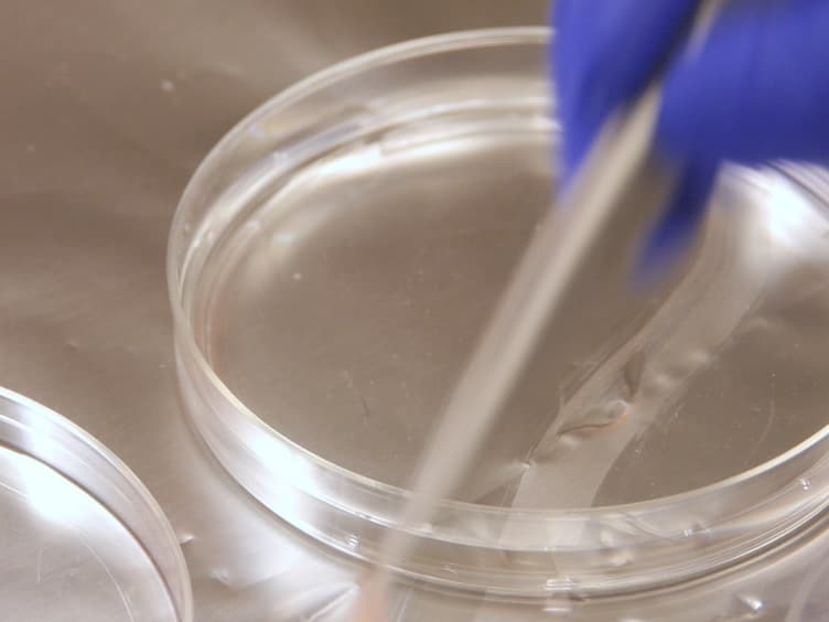 Isolation and Culture of Primary Mouse Keratinocytes from Neonatal and Adult Mouse Skin
