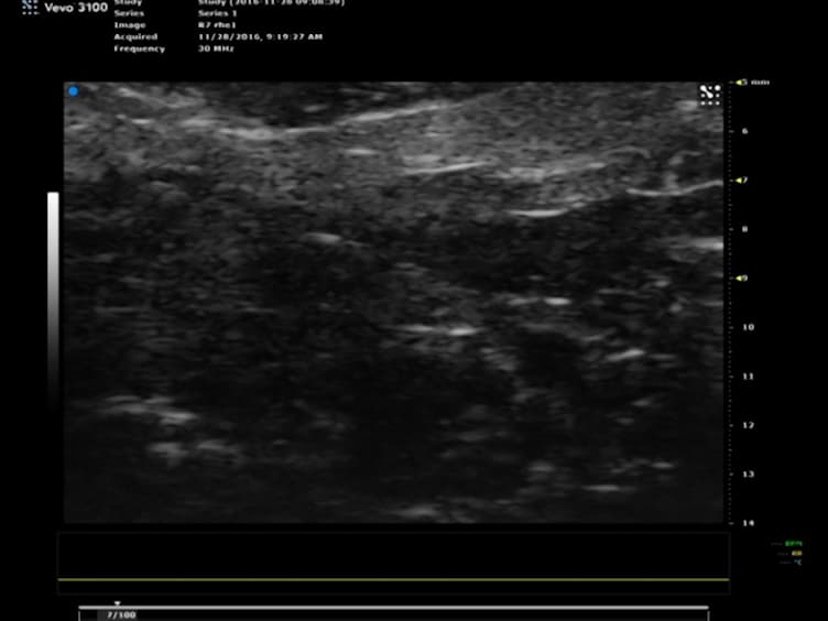 Ultrasonography in Experimental Reproductive Investigations on Rats