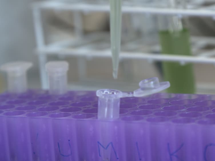Determination of the Glycogen Content in Cyanobacteria