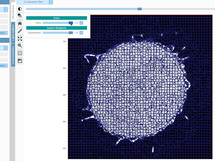 Volume Segmentation and Analysis of Biological Materials Using SuRVoS (Super-region Volume Segmentation) Workbench