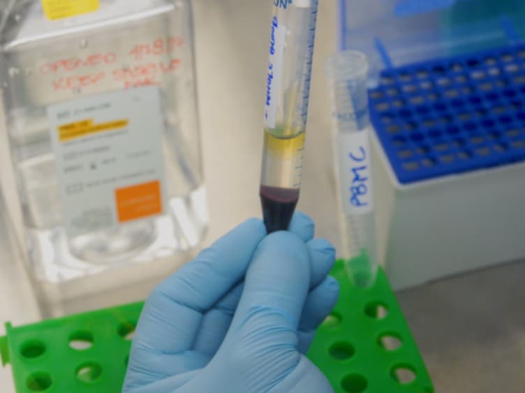 A Flow Cytometry-Based Cytotoxicity Assay for the Assessment of Human NK Cell Activity
