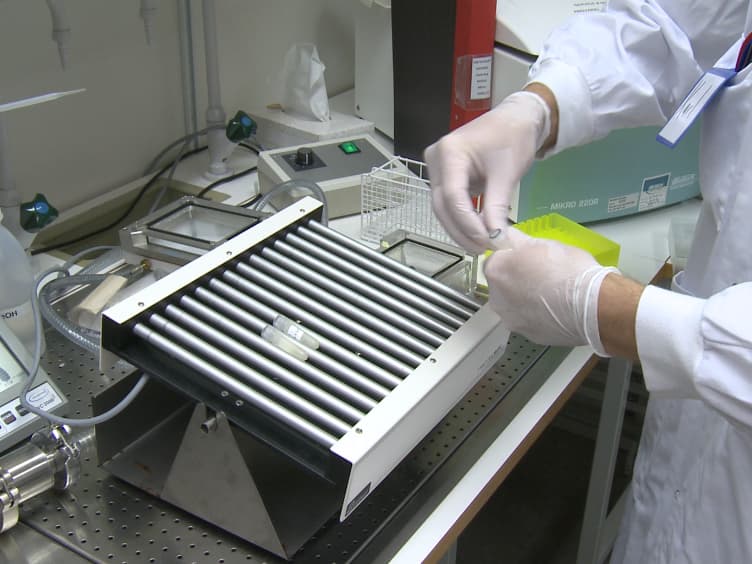 Sample Preparation for Endopeptidomic Analysis in Human Cerebrospinal Fluid