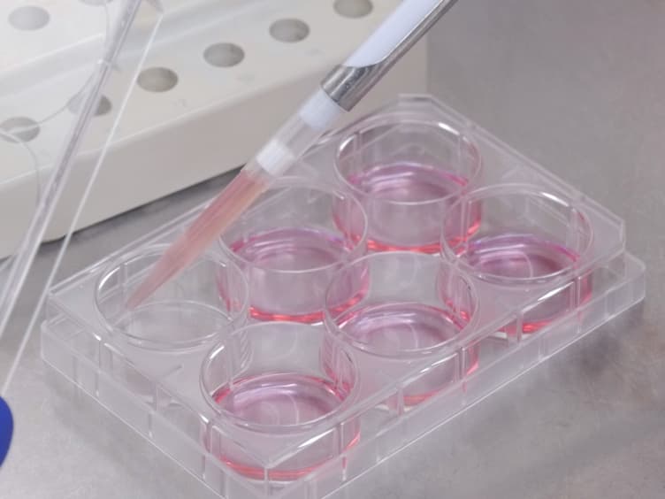Efficient Generation and Editing of Feeder-free IPSCs from Human Pancreatic Cells Using the CRISPR-Cas9 System