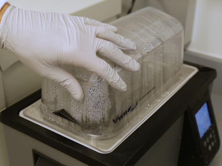Modelling Zika Virus Infection of the Developing Human Brain In Vitro Using Stem Cell Derived Cerebral Organoids
