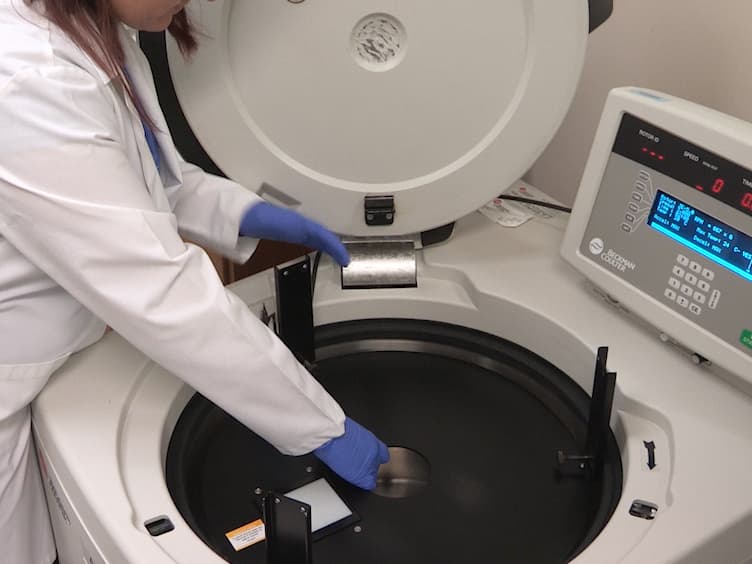 Preparation of Primary Acute Lymphoblastic Leukemia Cells in Different Cell Cycle Phases by Centrifugal Elutriation