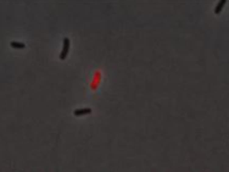 Live Cell Fluorescence Microscopy to Observe Essential Processes During Microbial Cell Growth