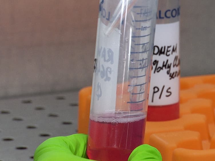Methods for Analyzing the Impacts of Natural Uranium on In Vitro Osteoclastogenesis