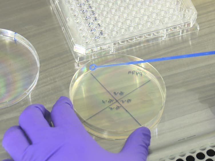 Investigating the Detrimental Effects of Low Pressure Plasma Sterilization on the Survival of <em>Bacillus subtilis</em> Spores Using Live Cell Microscopy
