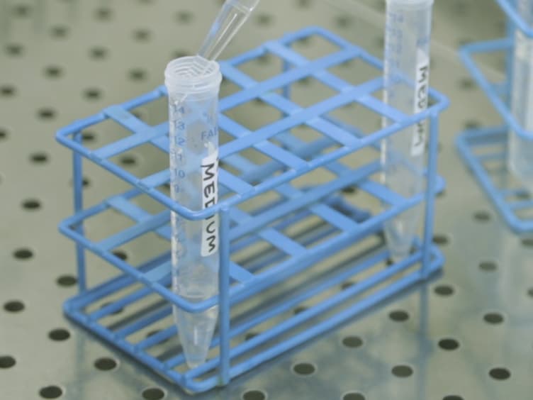 An Efficient In Vitro Transposition Method by a Transcriptionally Regulated Sleeping Beauty System Packaged into an Integration Defective Lentiviral Vector