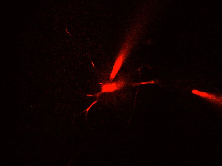 Two-photon Calcium Imaging in Neuronal Dendrites in Brain Slices